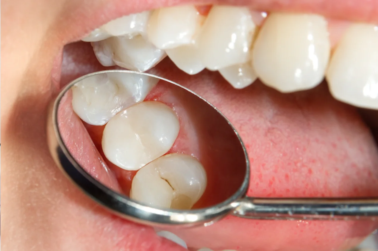 Dentisteria