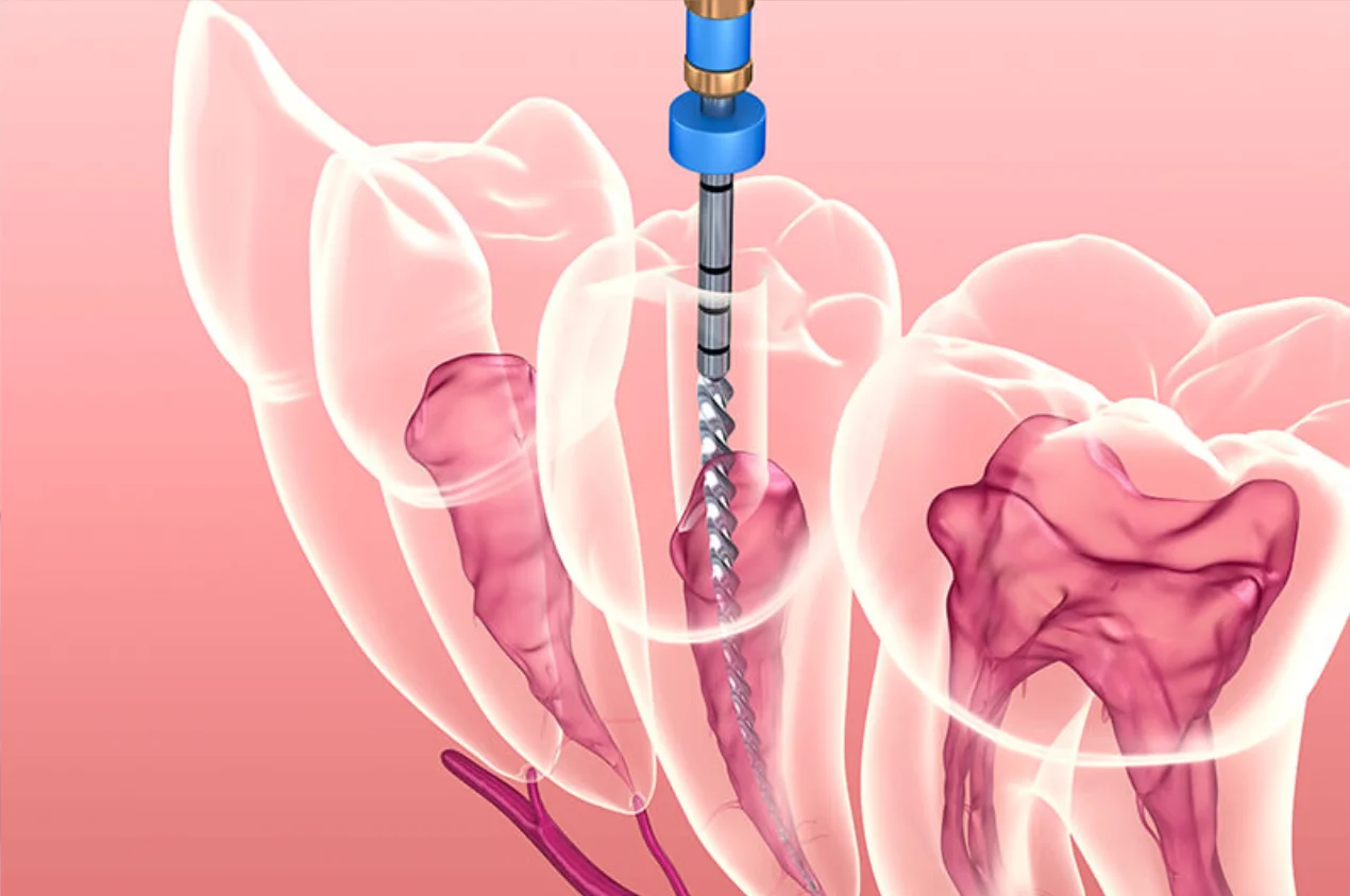 Endodontia