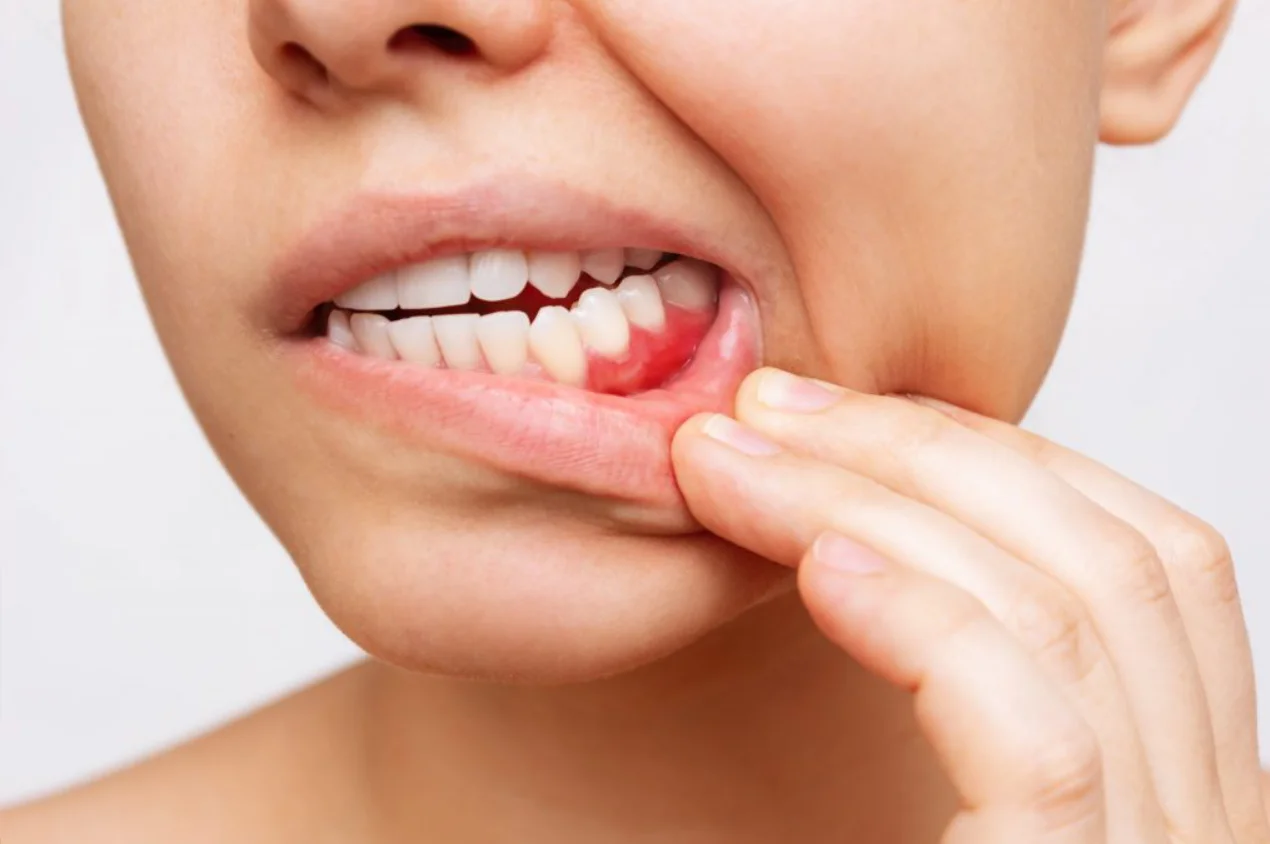 Periodontologia